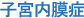 子宮内膜症